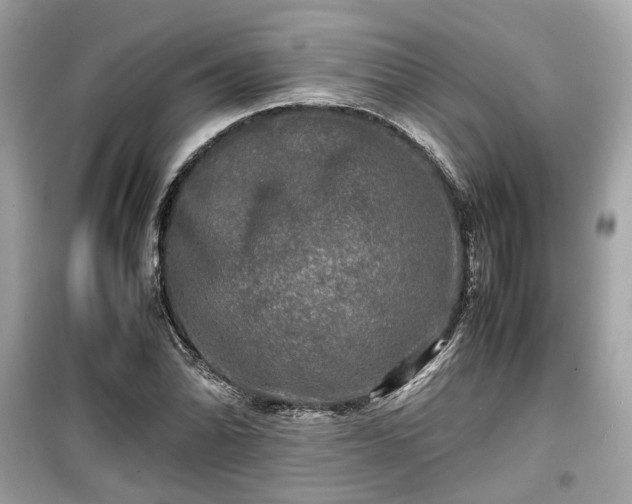 X0000099411070200805161015