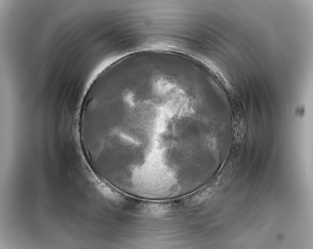 X0000099411086200805161015