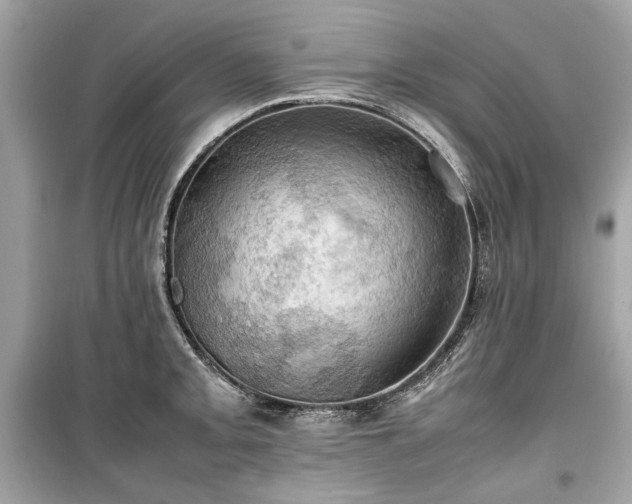 X0000099411093200805161015