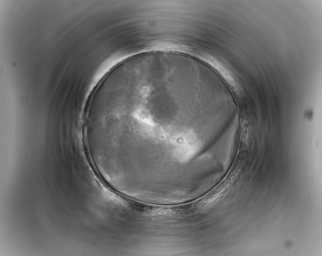 X0000099411094200805161015