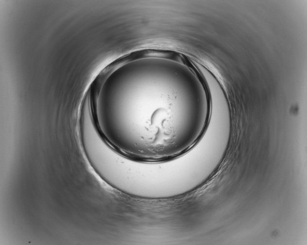 X0000099411103200805161015