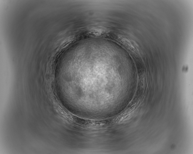 X0000099411105200805161014