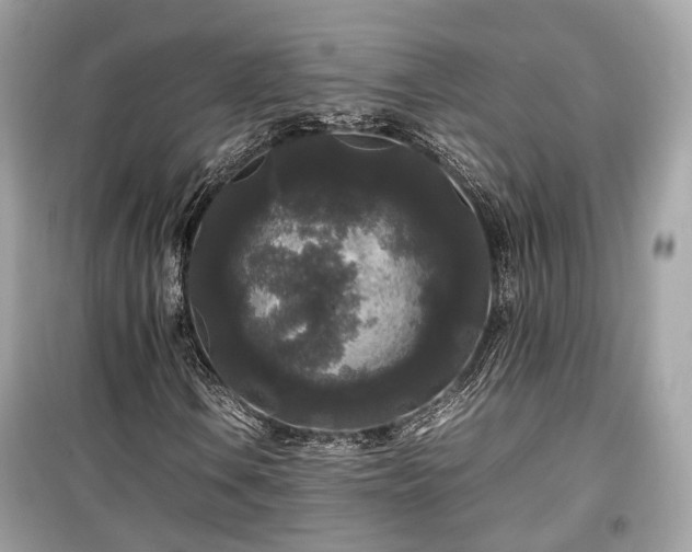 X0000099411106200805161014