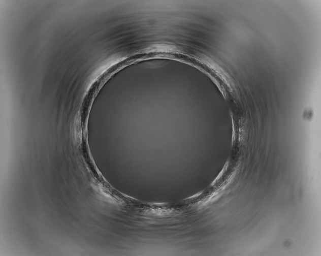 X0000099411117200805161014