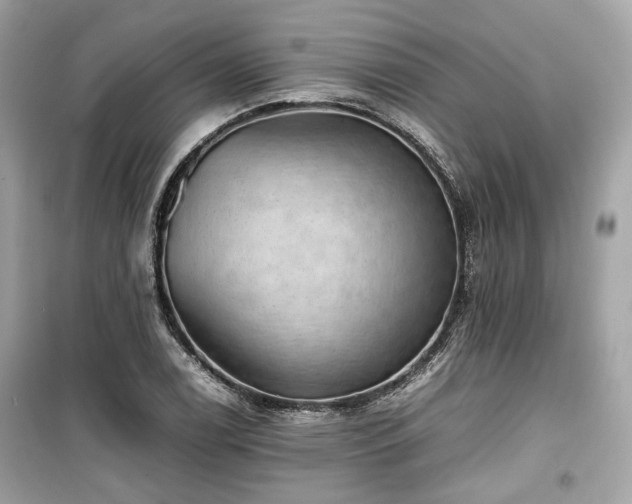 X0000099411122200805161014