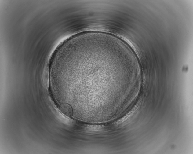 X0000099411123200805161014