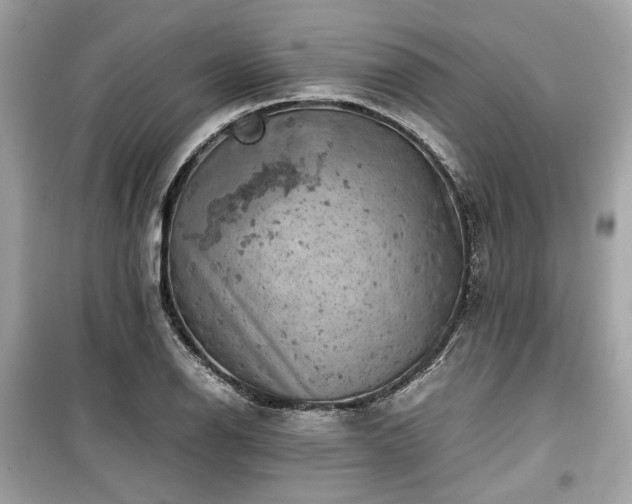 X0000099411126200805161014