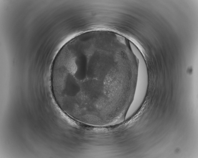 X0000099411142200805161014