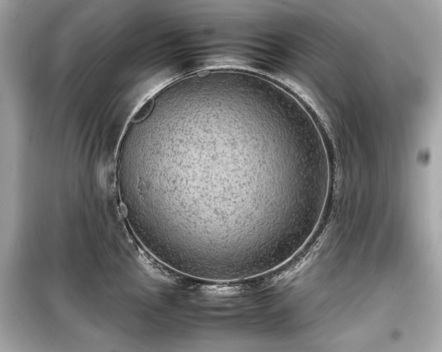 X0000099411145200805161015