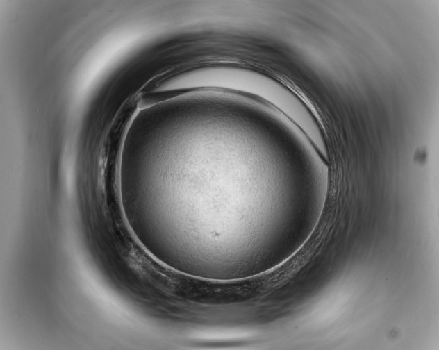 X0000099411151200805161015