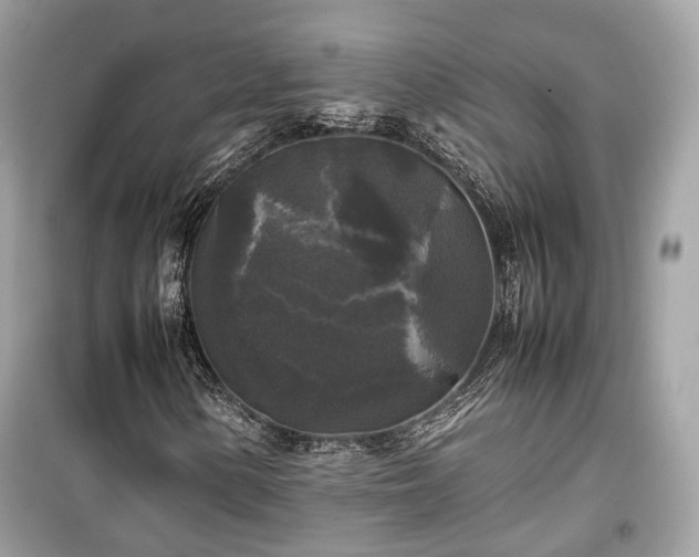 X0000099411154200805161014