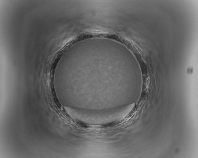 X0000099411157200805161014