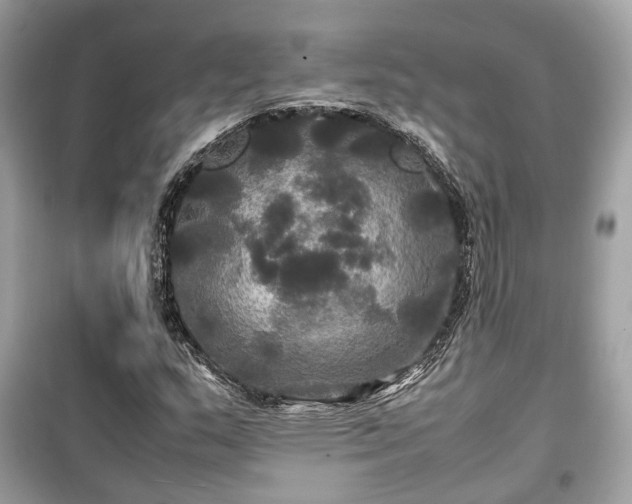 X0000099411159200805161014