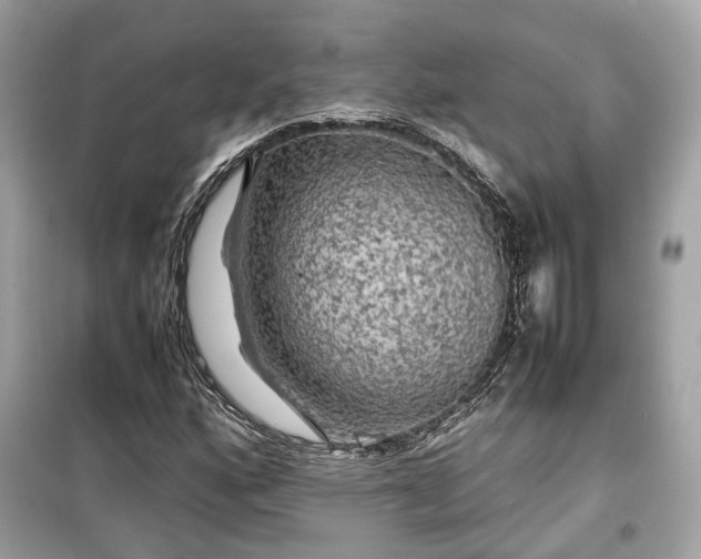 X0000099411160200805161014