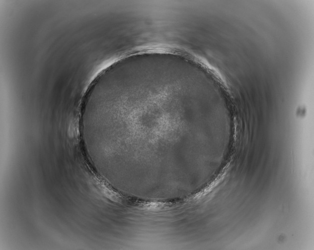 X0000099411166200805161014