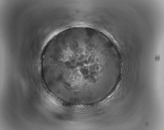 X0000099411167200805161014