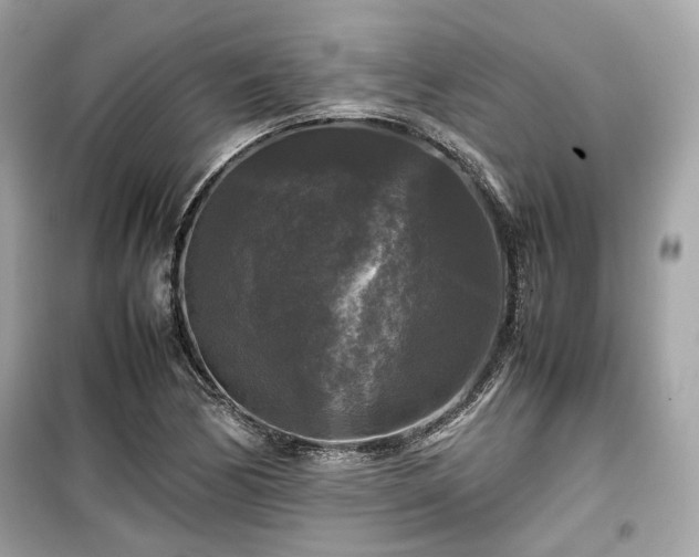 X0000099411170200805161014