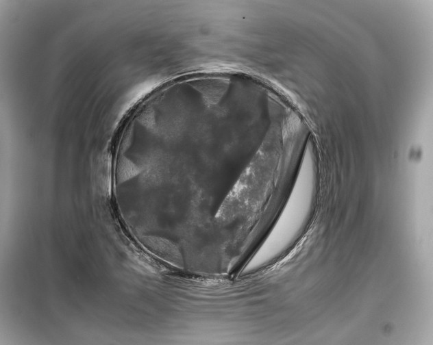 X0000099411171200805161014