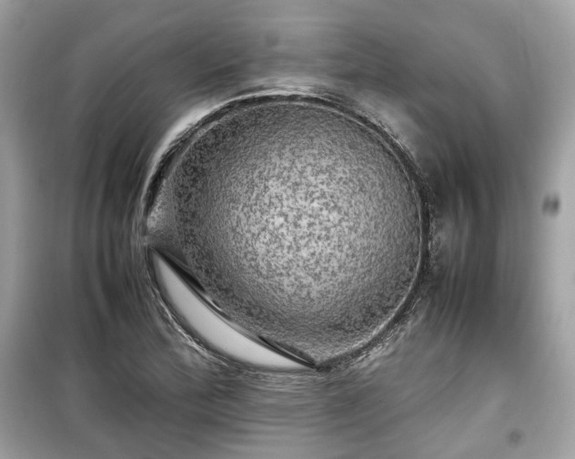 X0000099411172200805161013