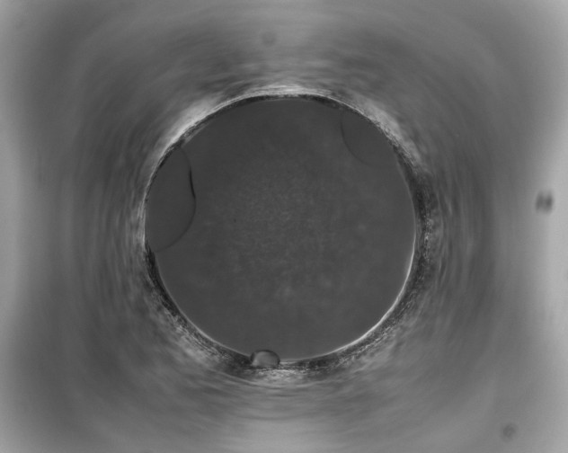 X0000099411173200805161013