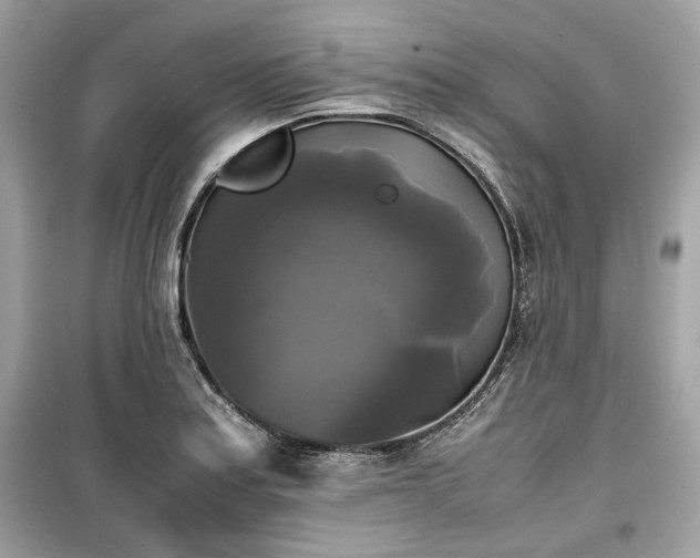 X0000099411179200805161013