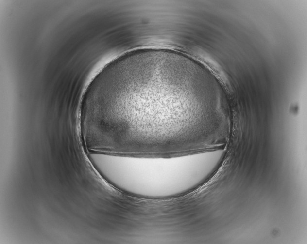 X0000099411188200805161013