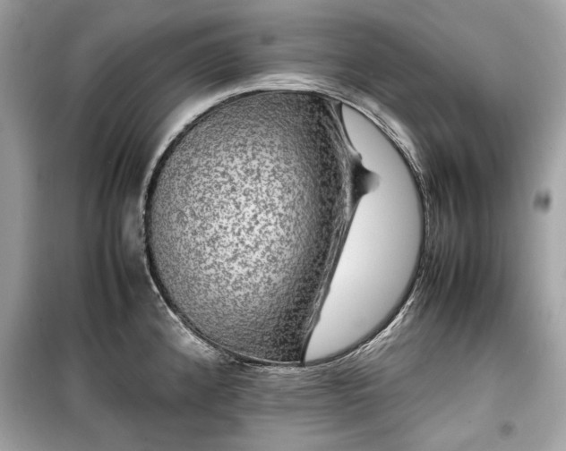 X0000099411192200805161013