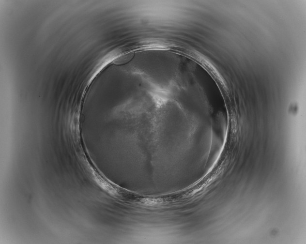 X0000099411194200805161013