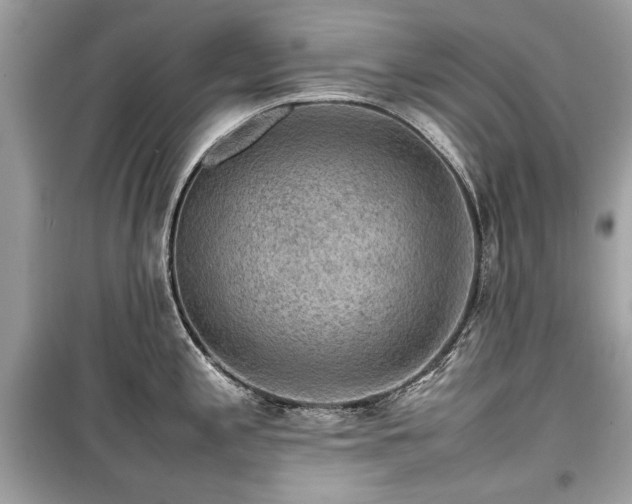 X0000099411197200805161013