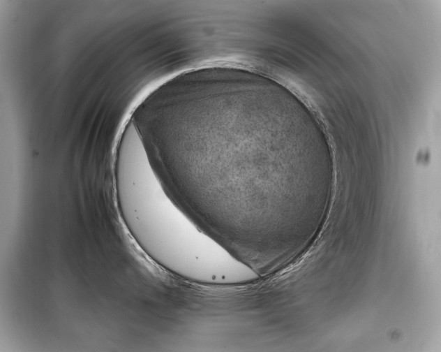 X0000099411200200805161013