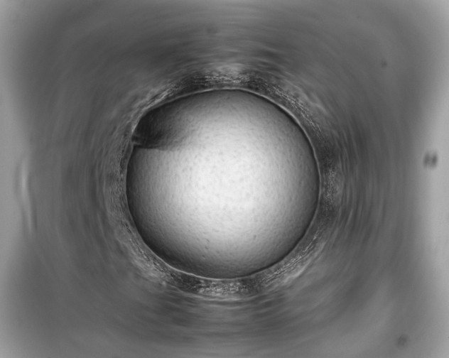 X0000099411201200805161012