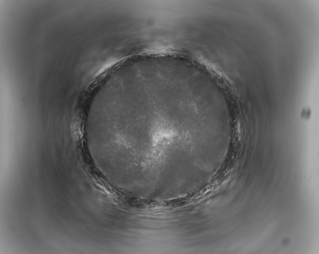 X0000099411206200805161012