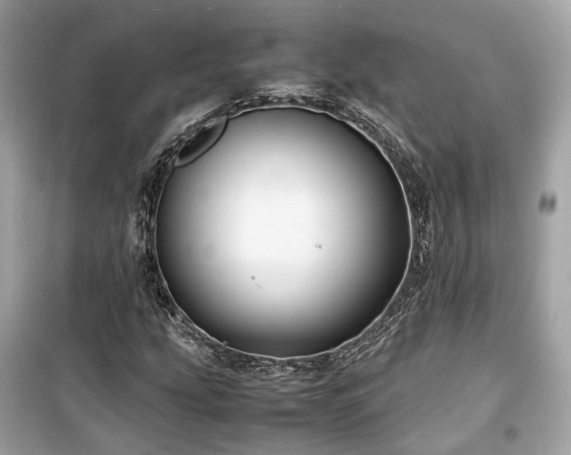 X0000099411207200805161012