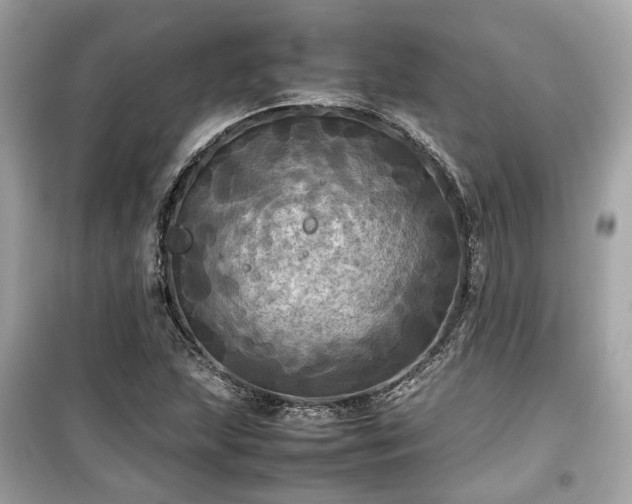 X0000099411215200805161012