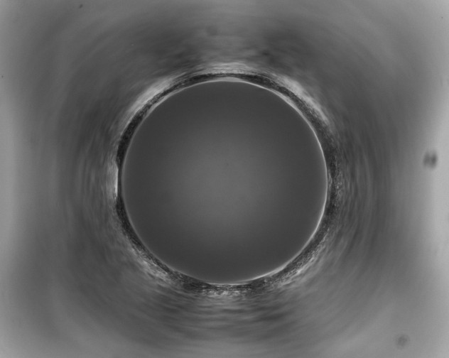X0000099411221200805161013