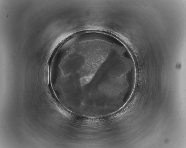 X0000099411223200805161013