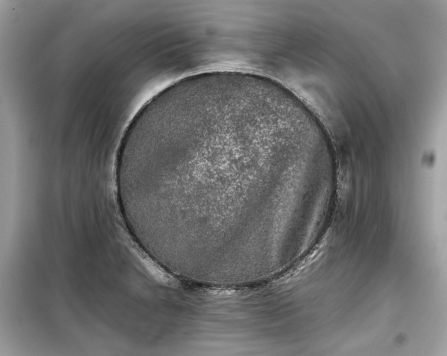 X0000099411230200805161013