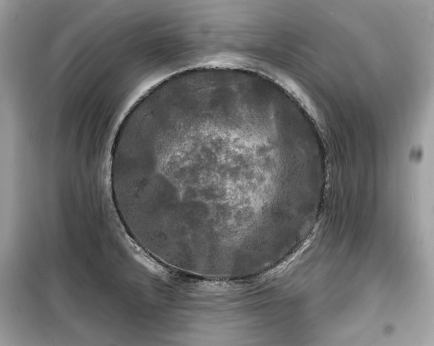 X0000099411232200805161013