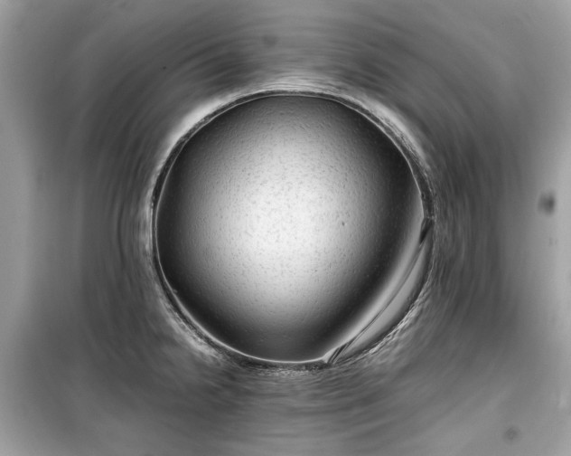 X0000099411238200805161013