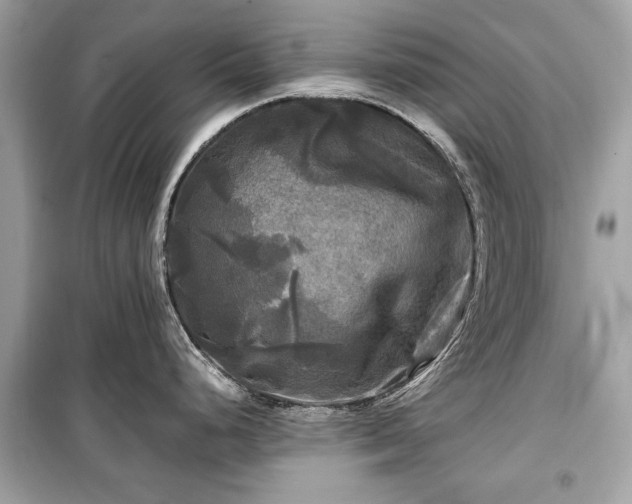 X0000099411248200805161013