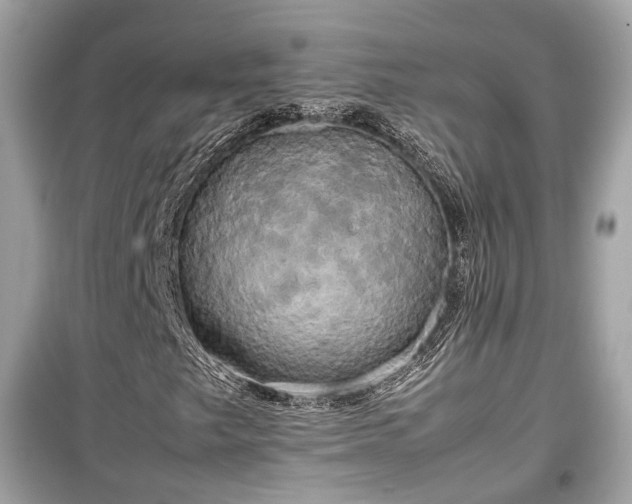 X0000099411249200805161012