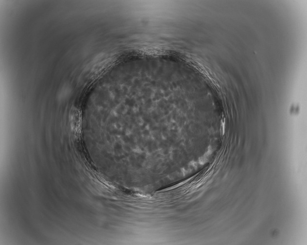 X0000099411251200805161012