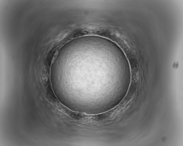 X0000099411253200805161012