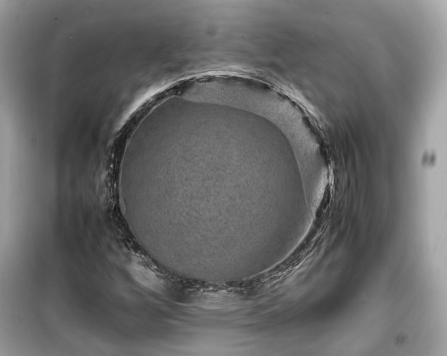 X0000099411256200805161012