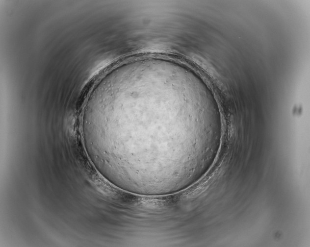 X0000099411258200805161012
