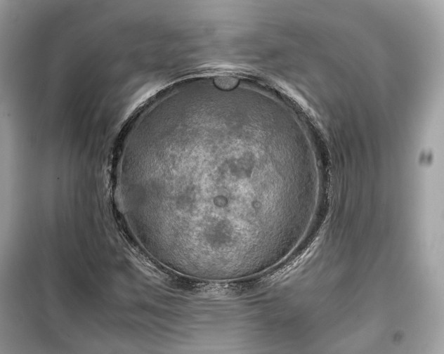 X0000099411259200805161012
