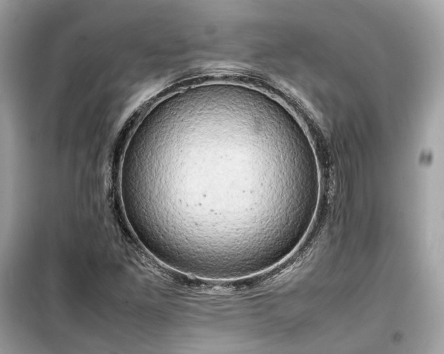 X0000099411261200805161012
