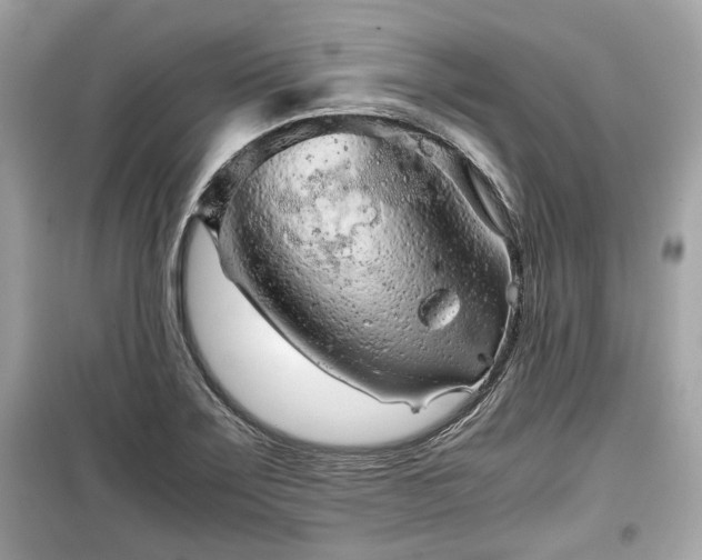 X0000099411275200805161012