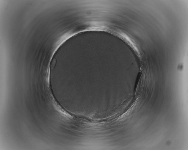 X0000099411276200805161012