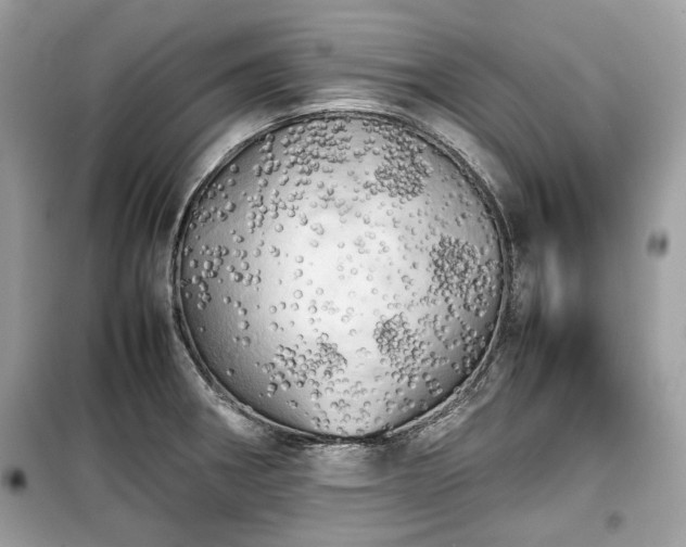 X0000099411282200805161012